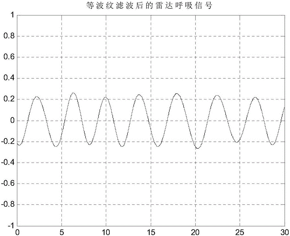 Respiratory pattern judgement method based on respiratory pattern monitoring radar