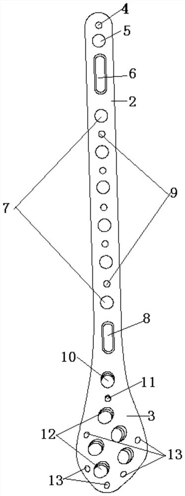 Thighbone far-end inner side bone fracture plate