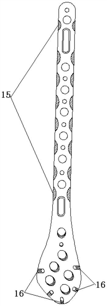 Thighbone far-end inner side bone fracture plate