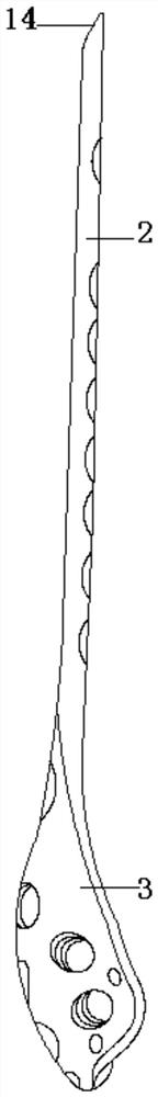 Thighbone far-end inner side bone fracture plate