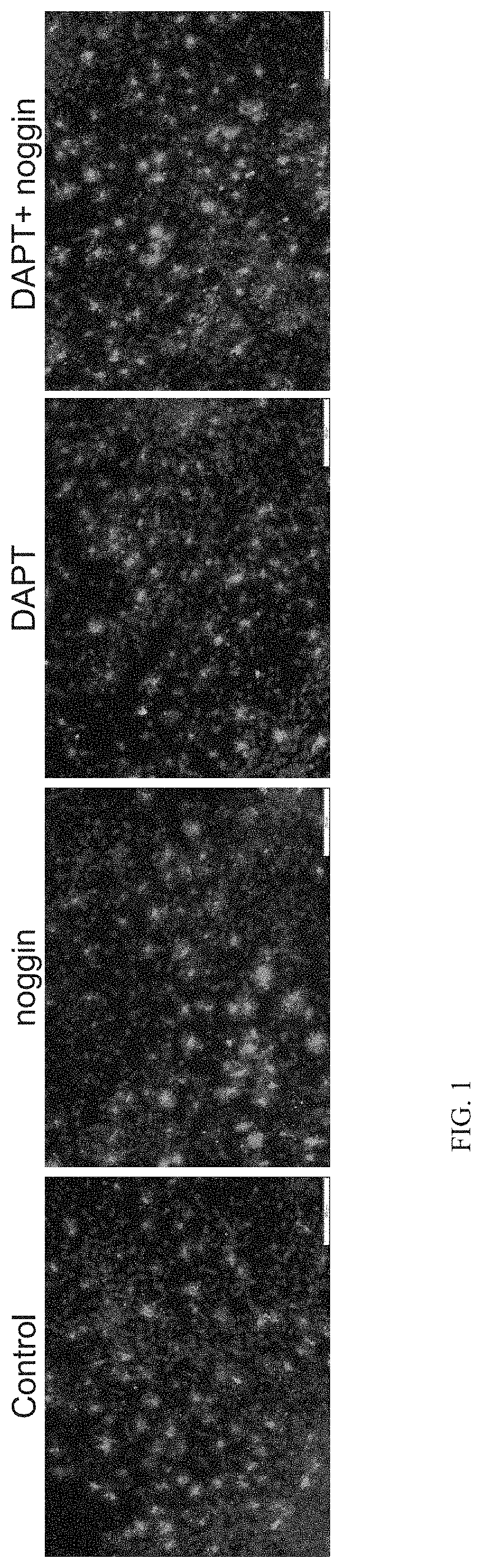 Methods of generating oligodendrocytes