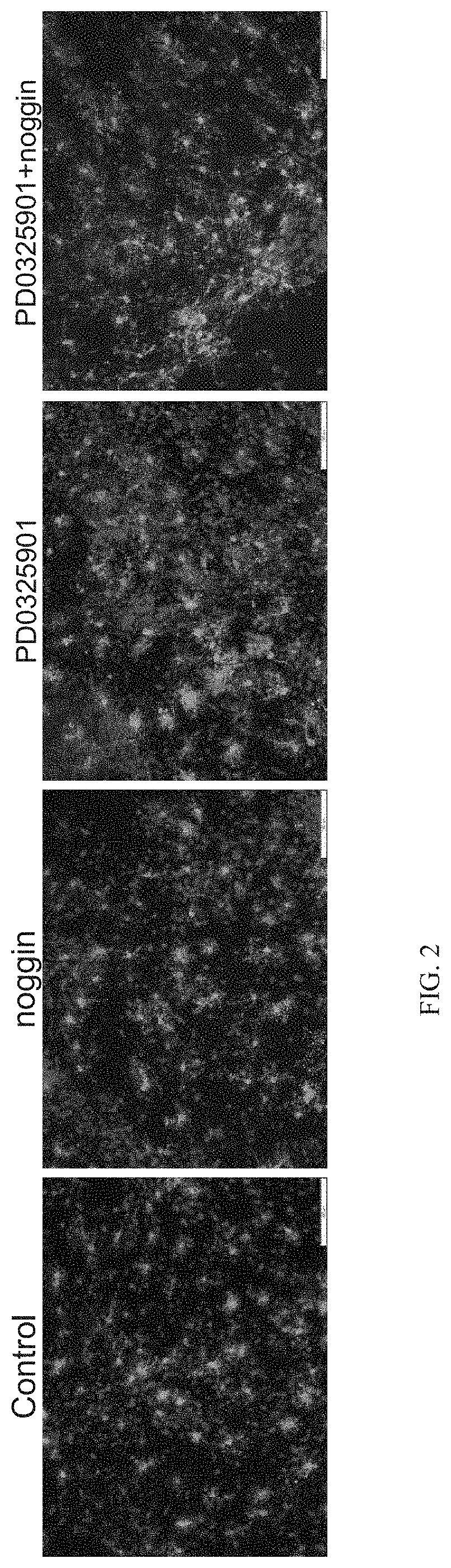 Methods of generating oligodendrocytes