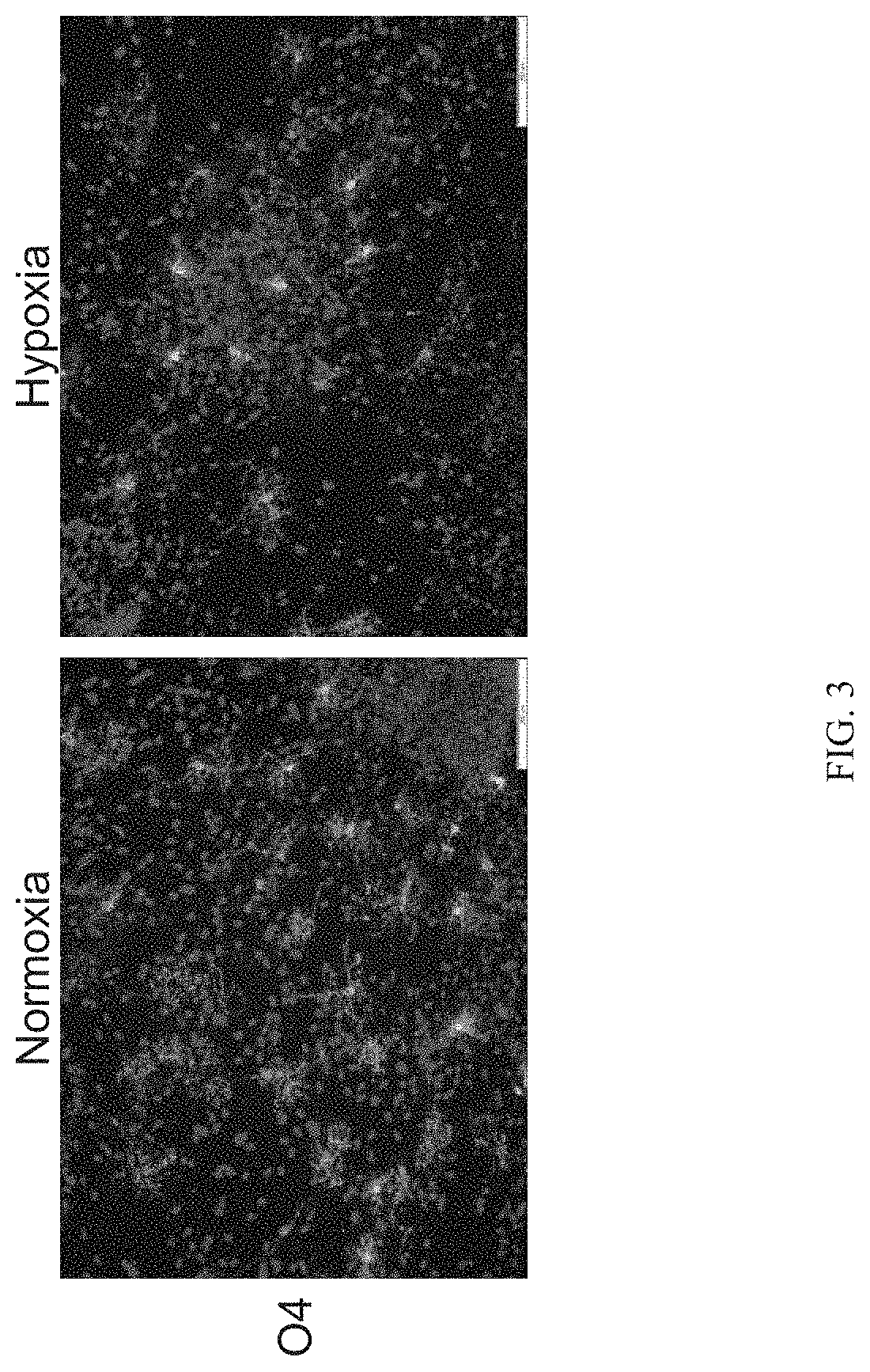 Methods of generating oligodendrocytes