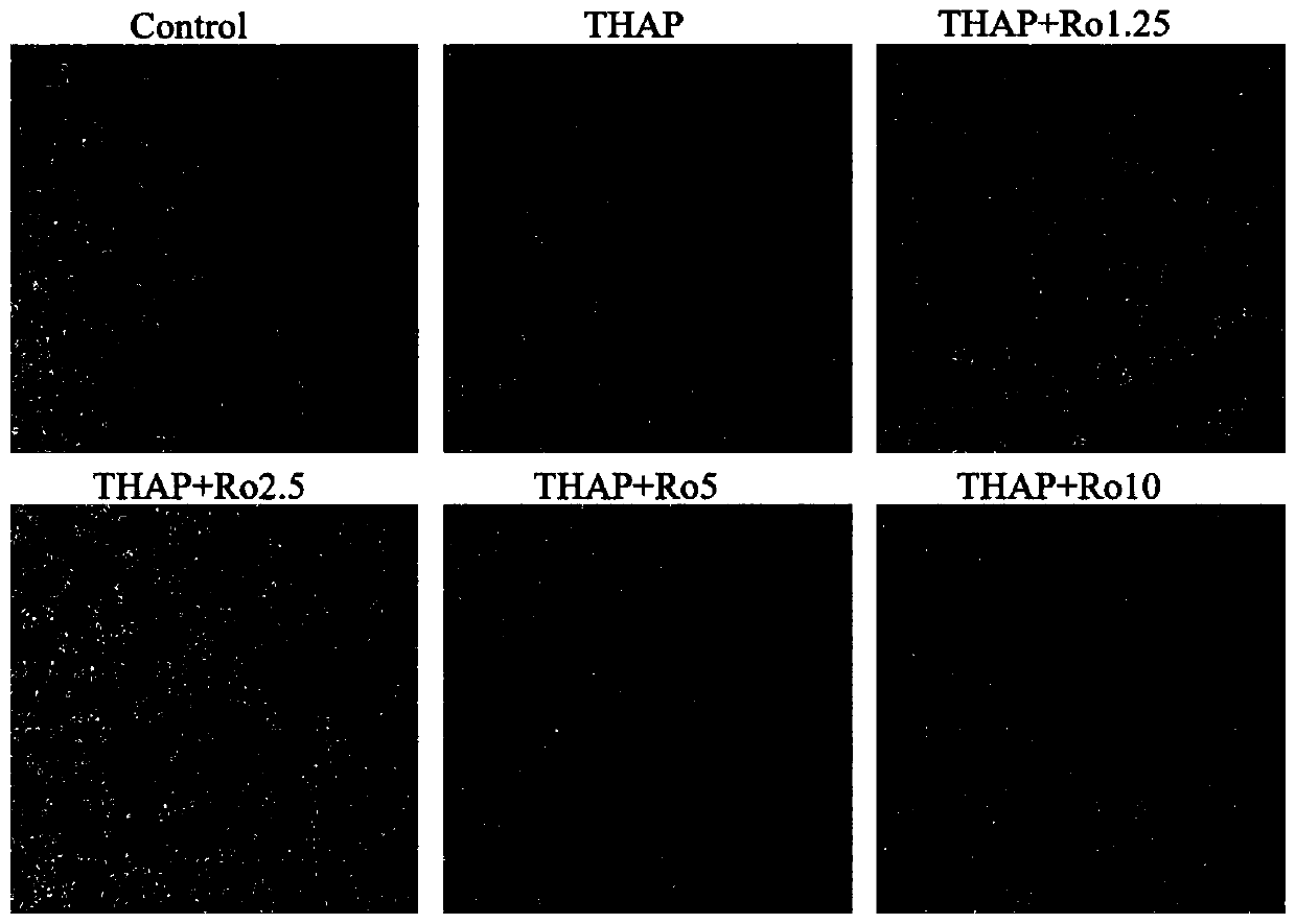 Application of PKC enzyme inhibitor in preparing drug for improving and protecting islet beta cell functions