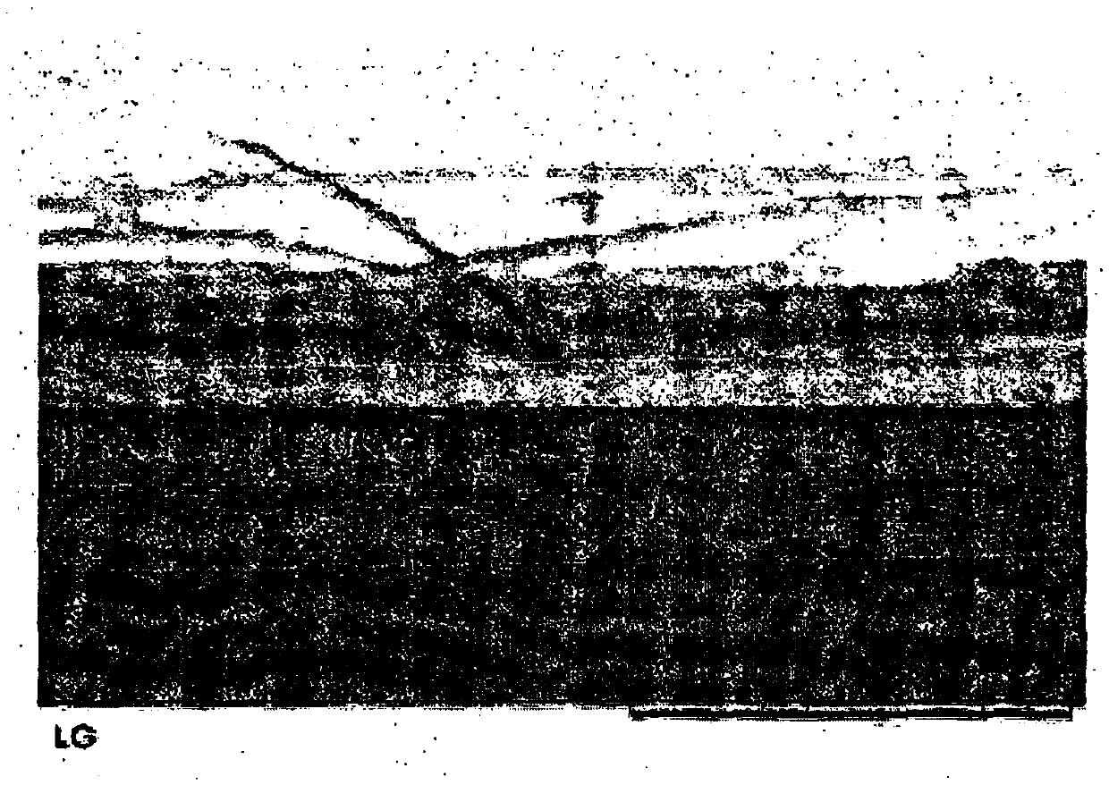 Method for preparing polyurethane support pad