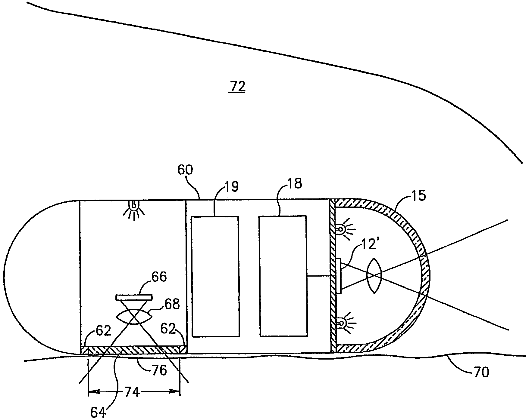 Method and device for imaging body lumens