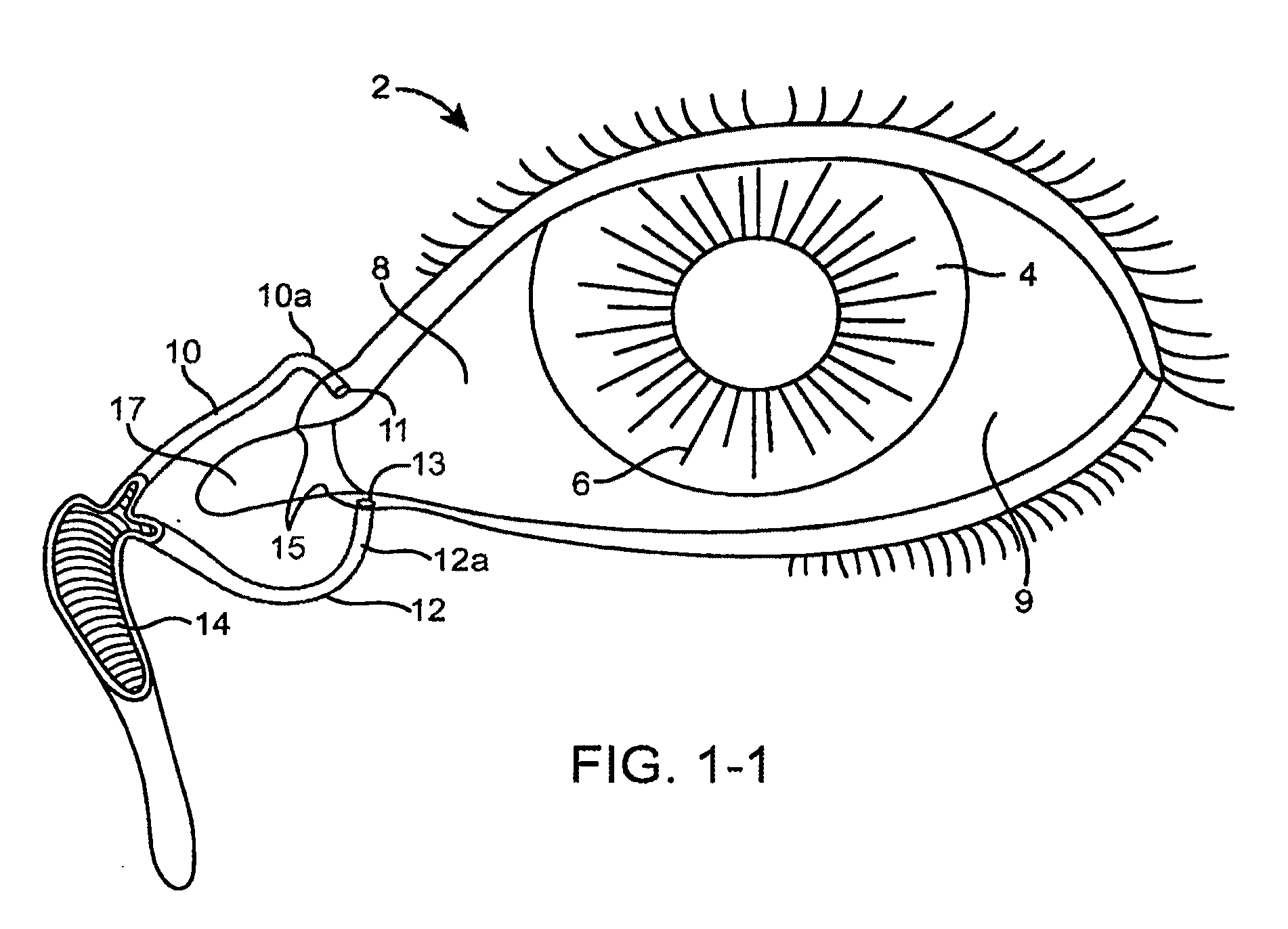 Drug delivery implants for inhibition of optical defects