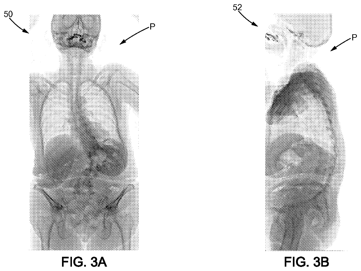 Method for designing a patient specific orthopaedic device