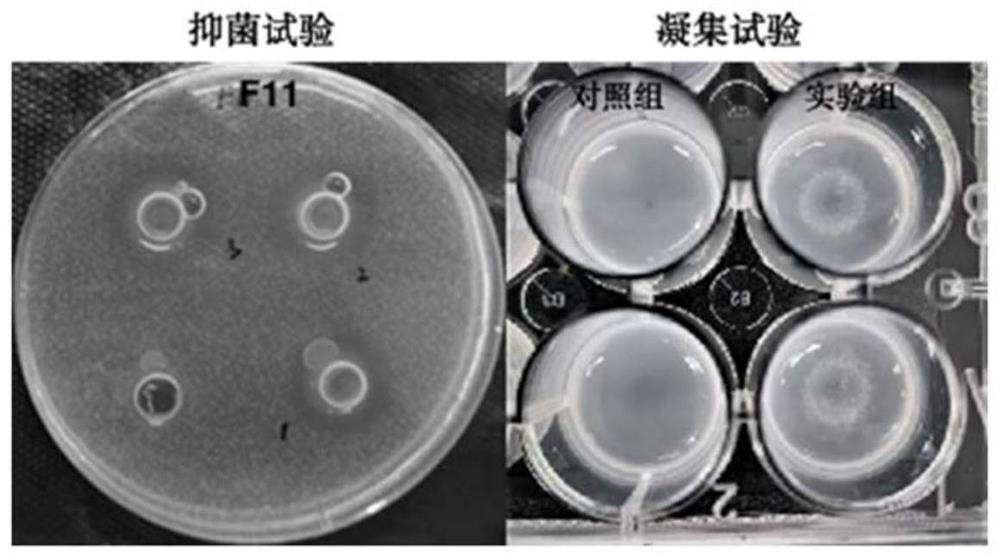 Lactobacillus paracasei and application thereof in prevention of streptococcus infection of infants