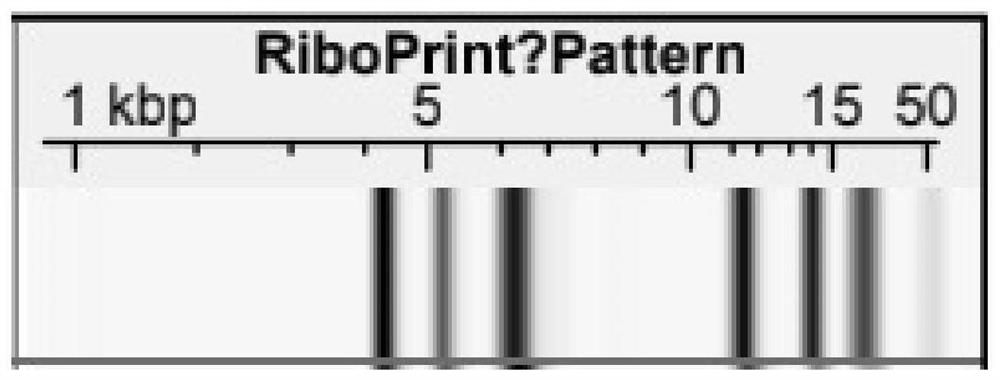 Lactobacillus paracasei and application thereof in prevention of streptococcus infection of infants