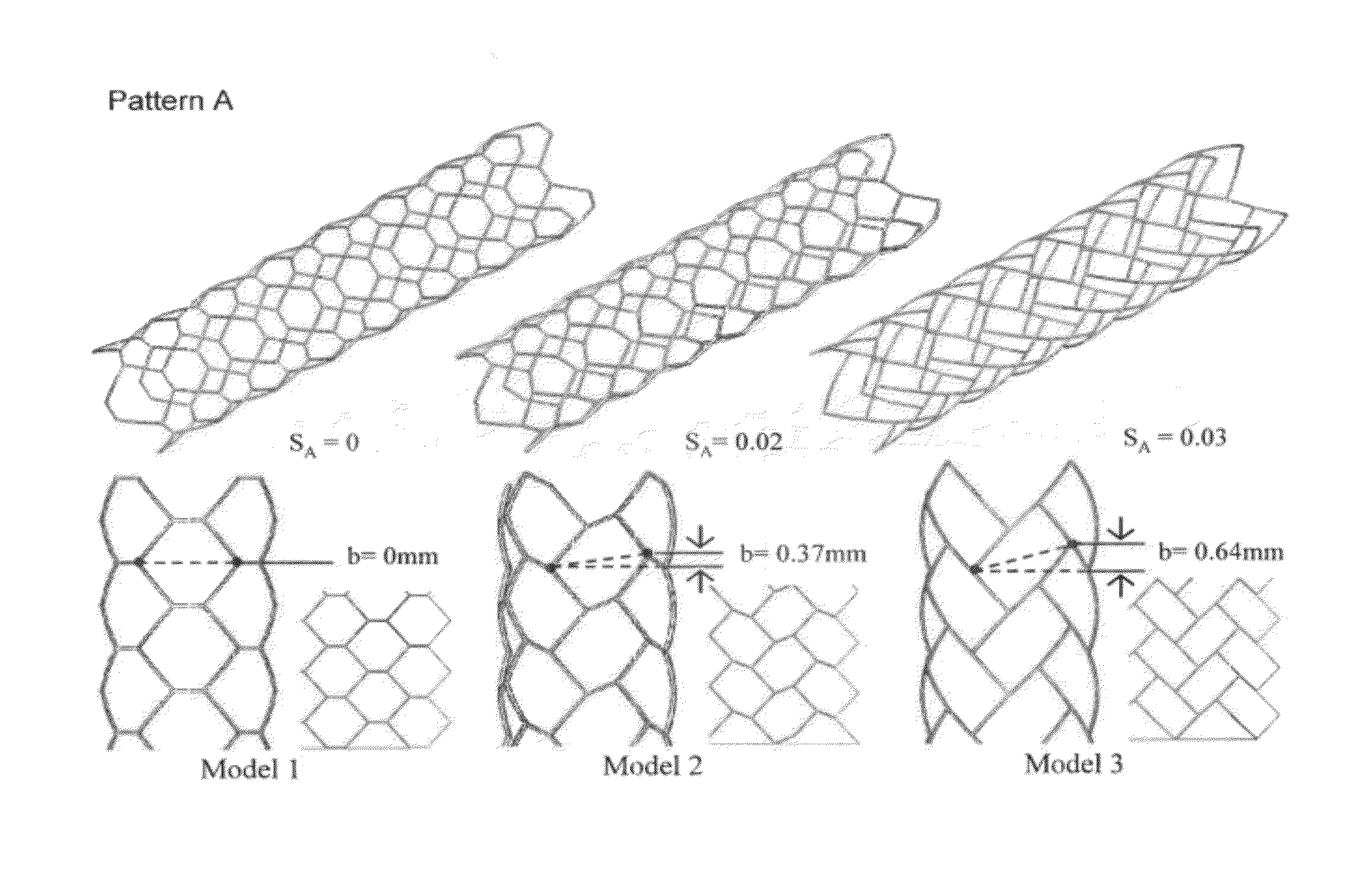 Stent to be used in tubular organ in vivo