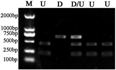 SNP locus closely related to orientation of capsicum fruit and its universal molecular marker, acquisition method and application thereof