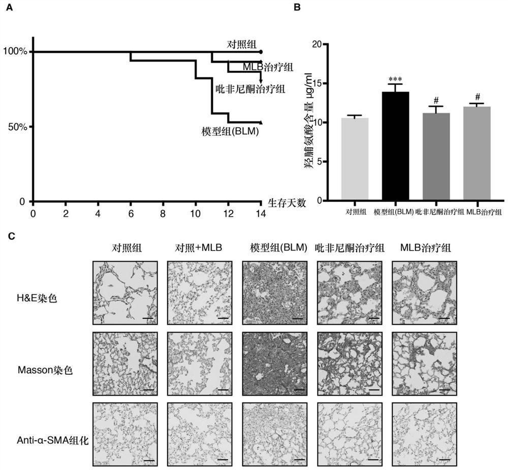 Application of magnesium salviae miltiorrhizae acetate in preparation of anti-pulmonary fibrosis medicine