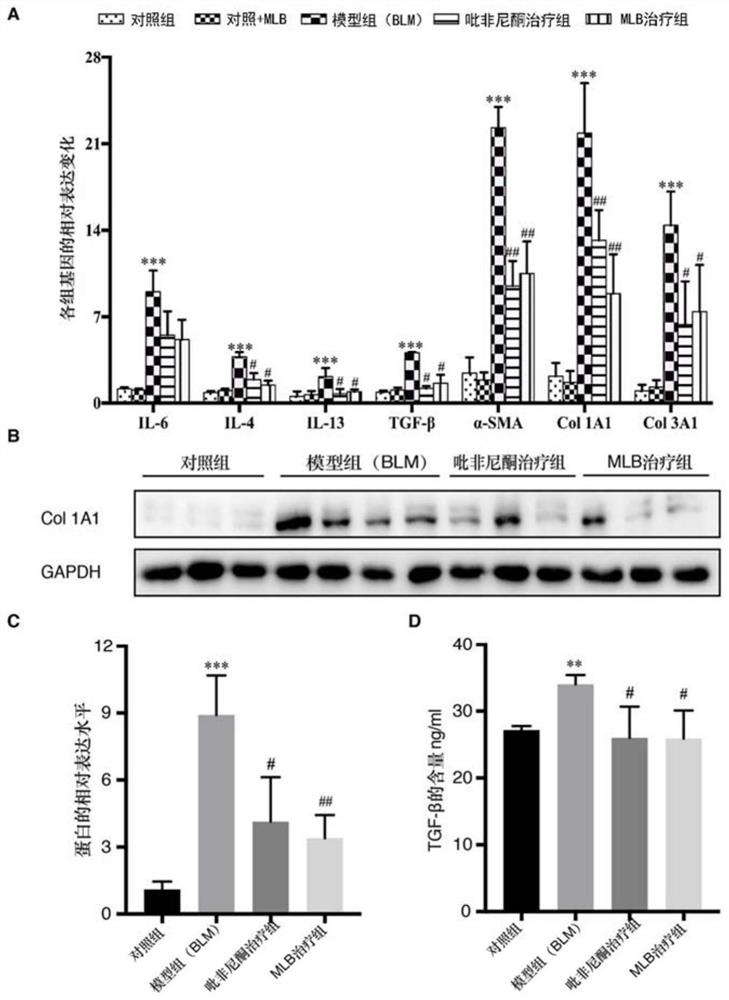 Application of magnesium salviae miltiorrhizae acetate in preparation of anti-pulmonary fibrosis medicine