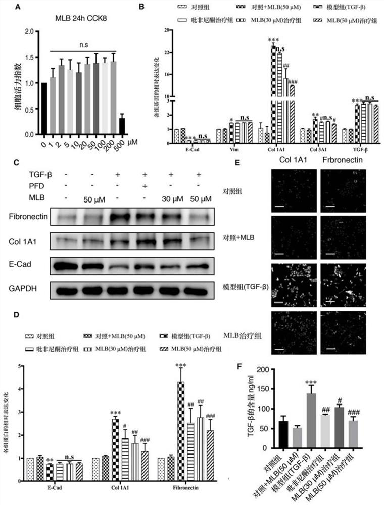 Application of magnesium salviae miltiorrhizae acetate in preparation of anti-pulmonary fibrosis medicine