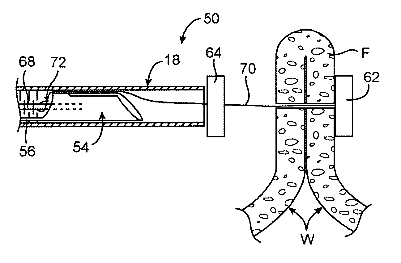 Apparatus and methods for positioning and securing anchors