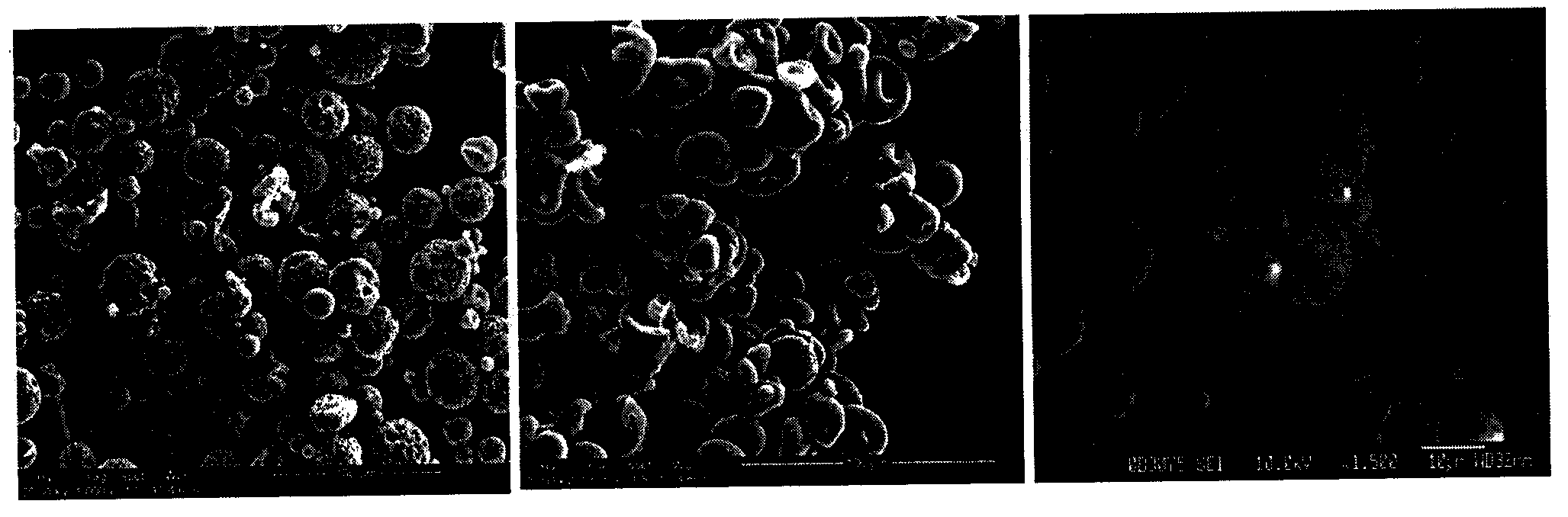 Exenatide long-acting microsphere preparation and preparation method thereof