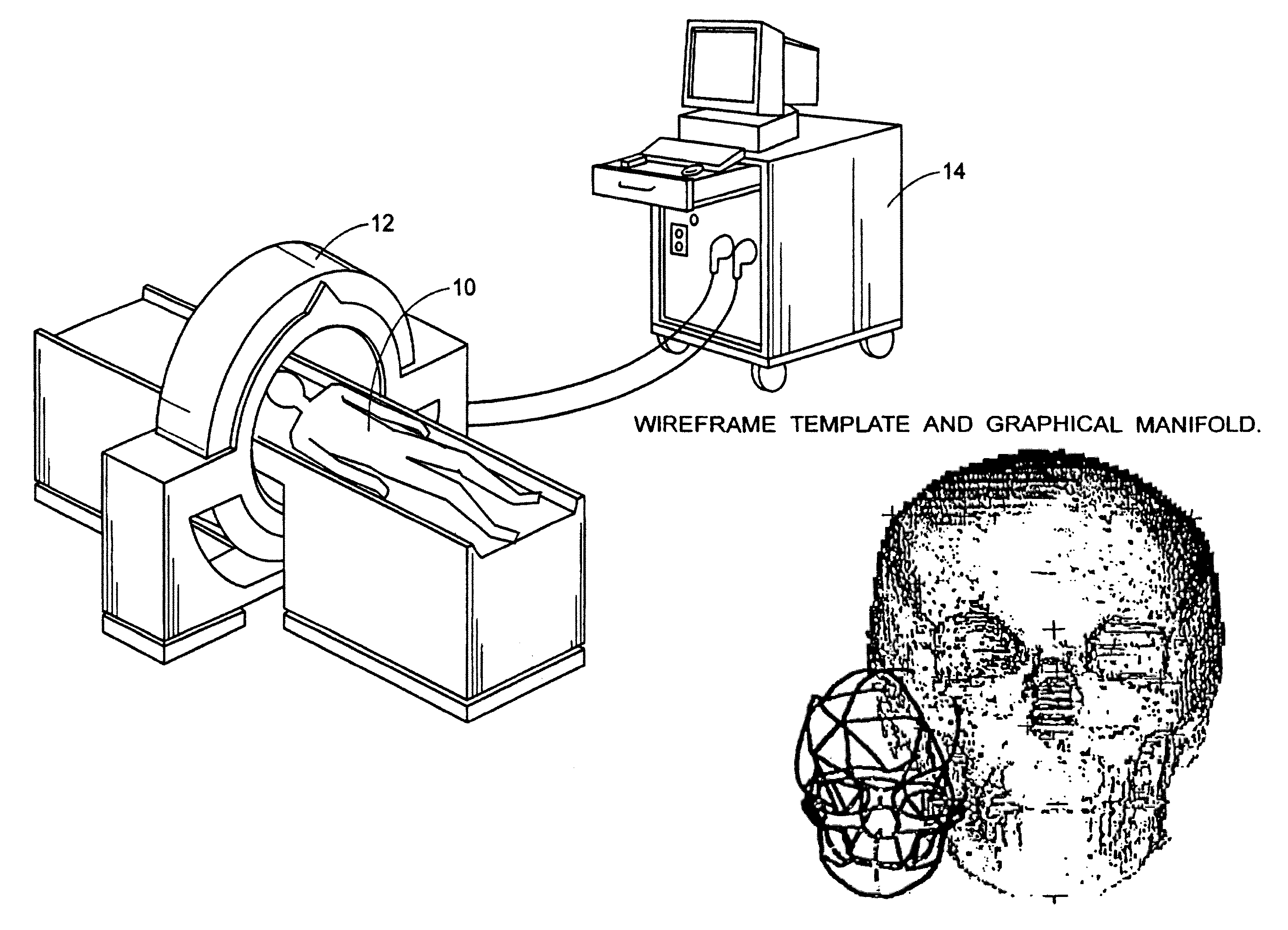 Producing a three dimensional model of an implant