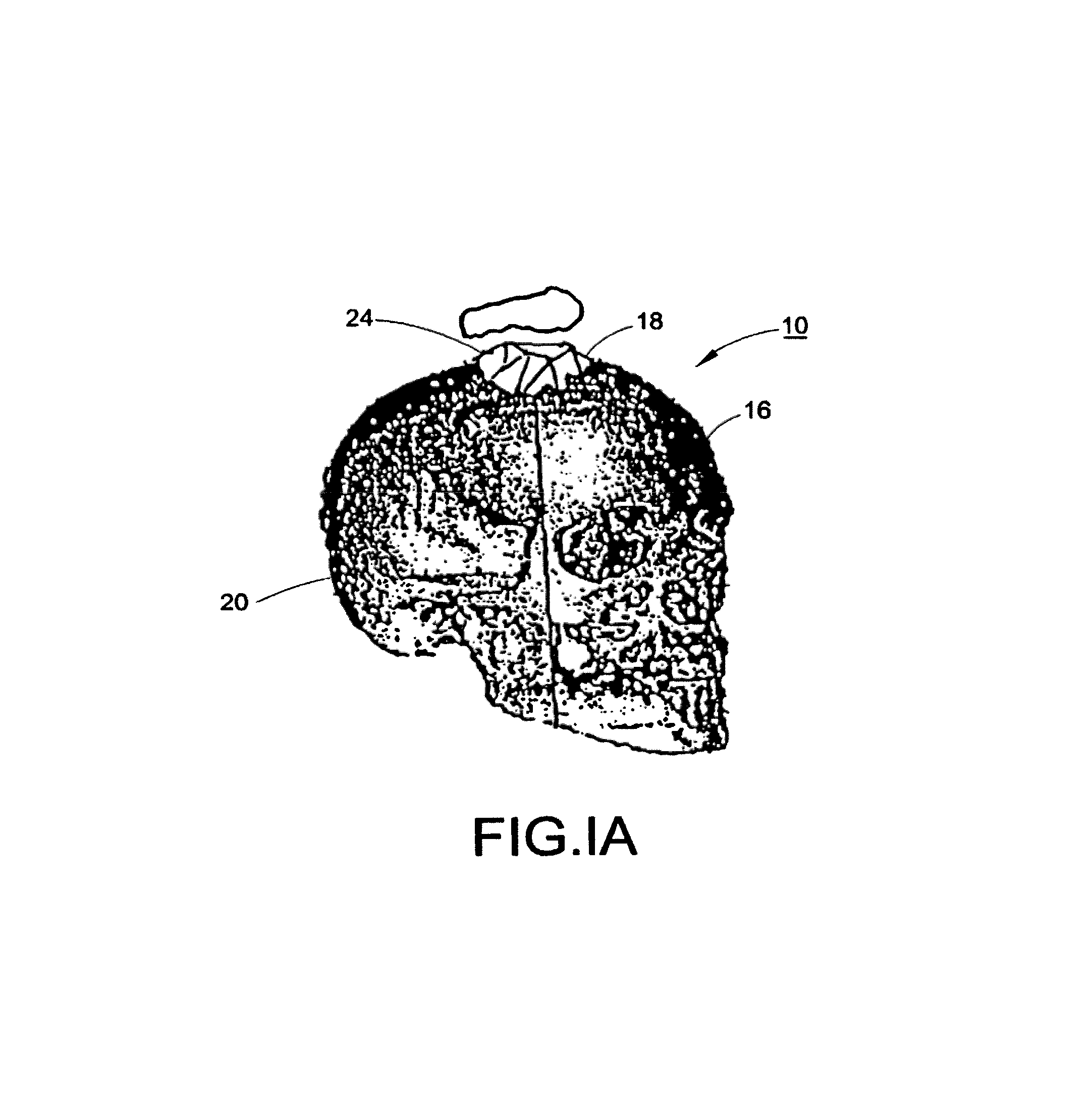 Producing a three dimensional model of an implant