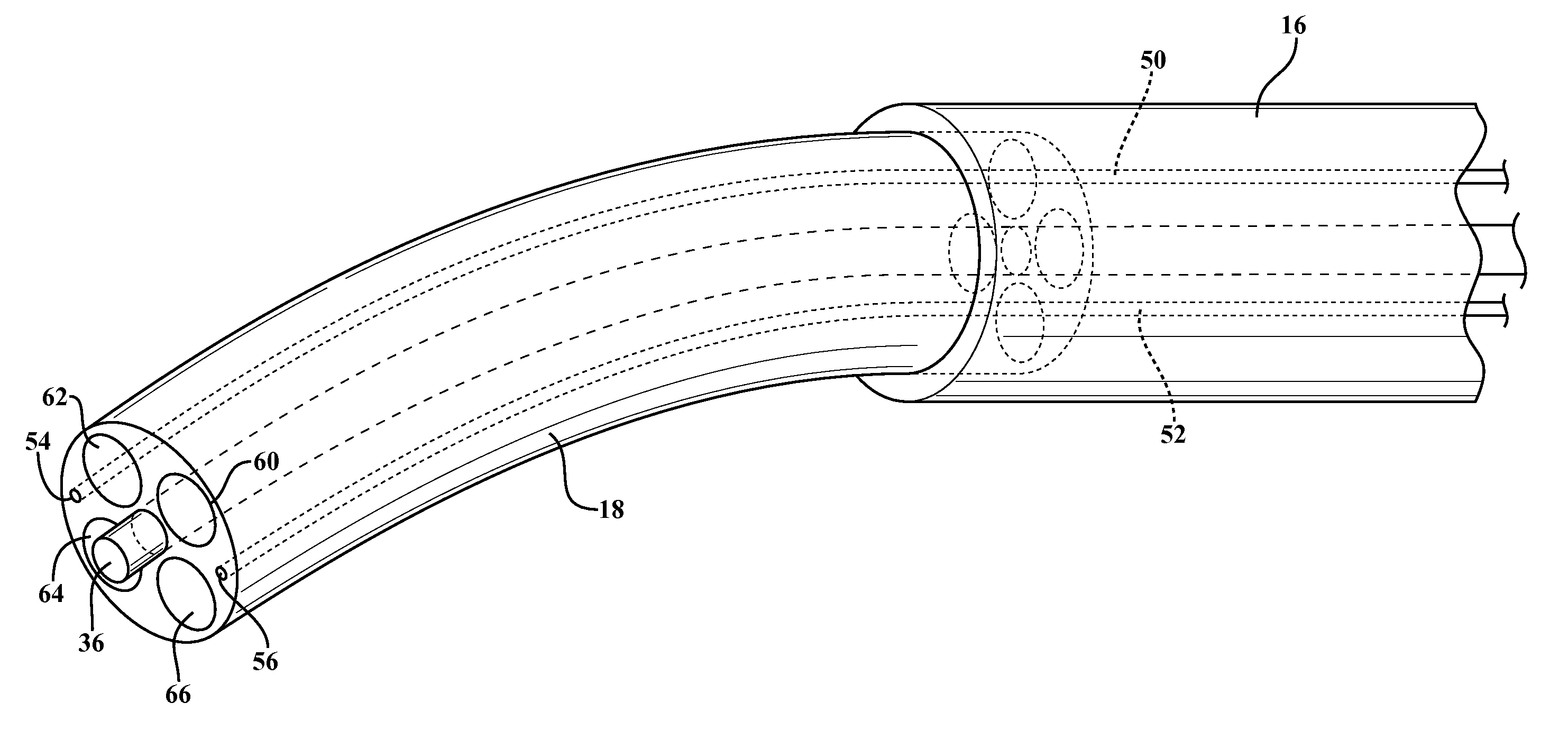 Method and apparatus for cold plasma treatment of internal organs