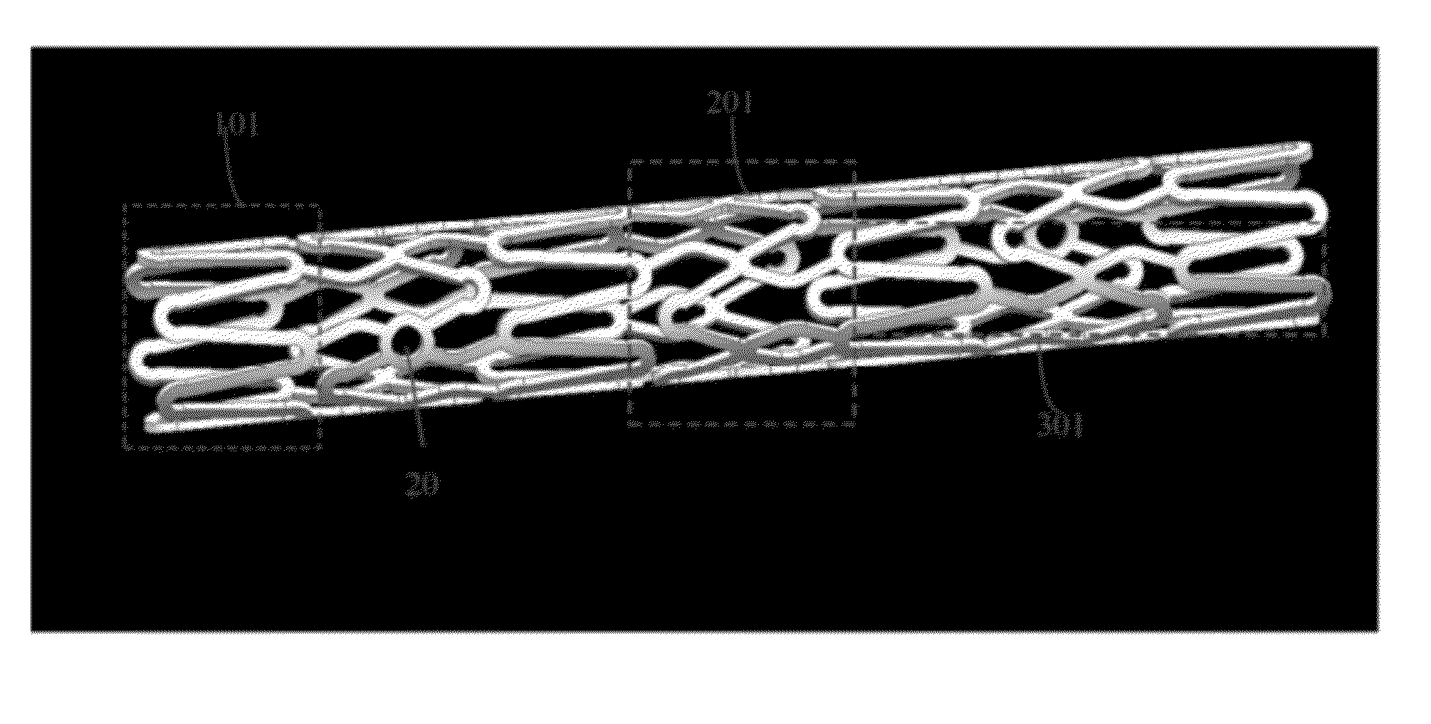 Biodegradable Drug Eluting stent Pattern