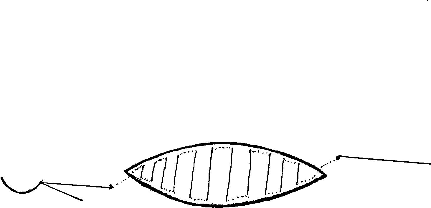 Beauty treatment suturing method for operation incision and traumatism wound