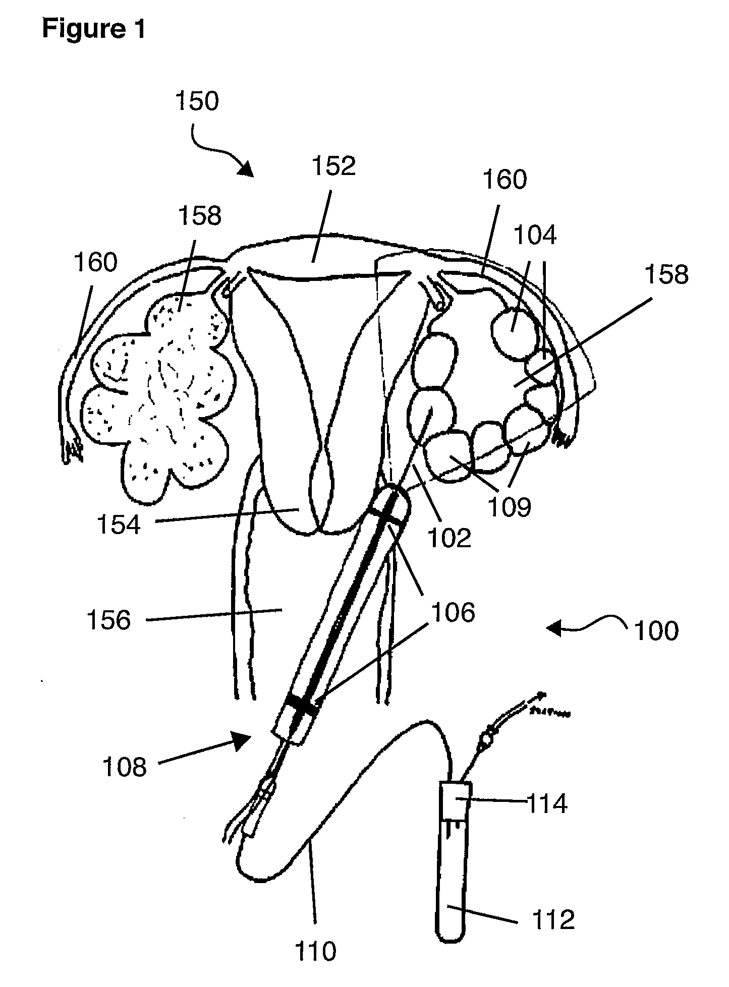 Sampling needle