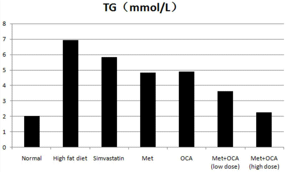 Obeticholic acid and metformin composition and application thereof