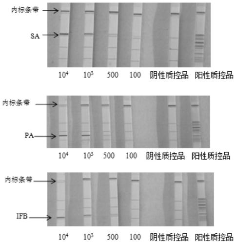 Kit for detecting respiratory pathogens of community-acquired pneumonia