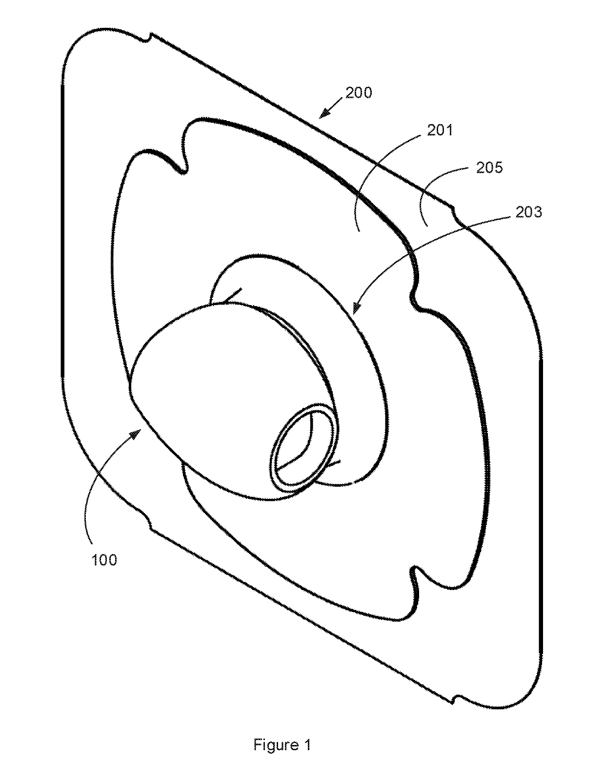 Tracheostoma valve