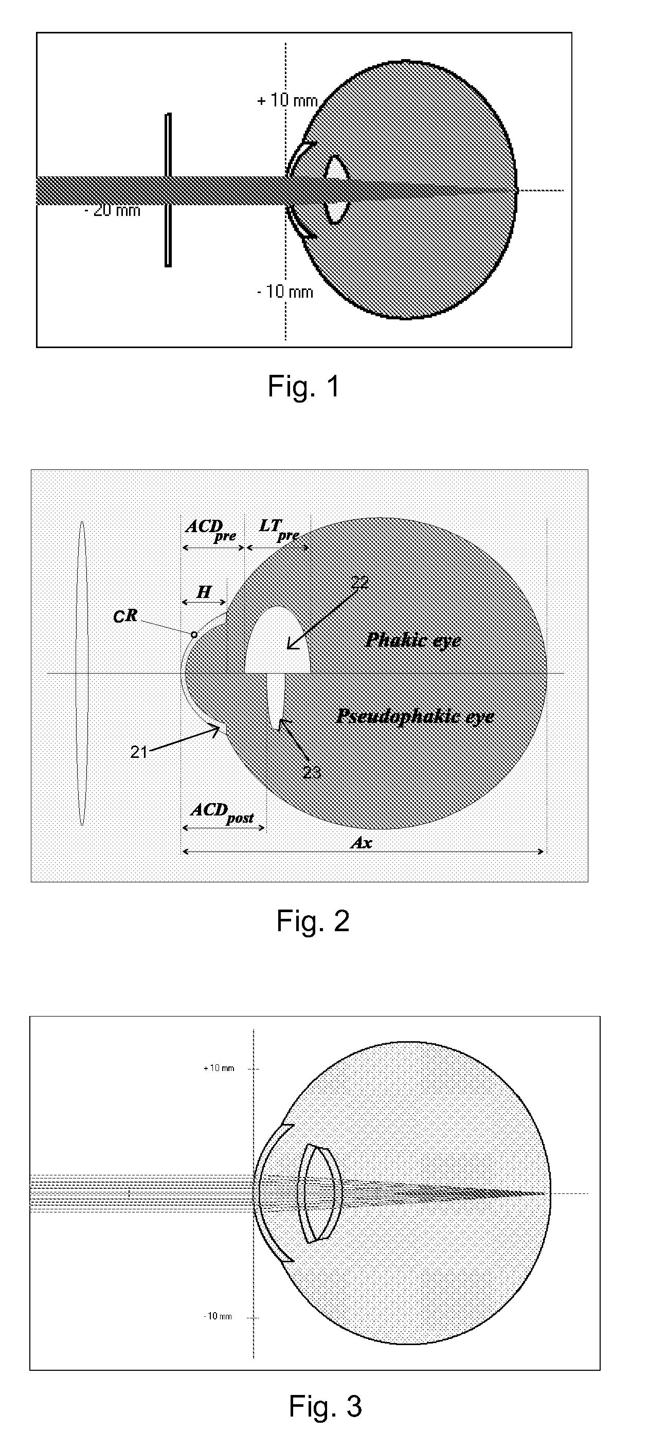 System and method for determining and predicting IOL power in situ