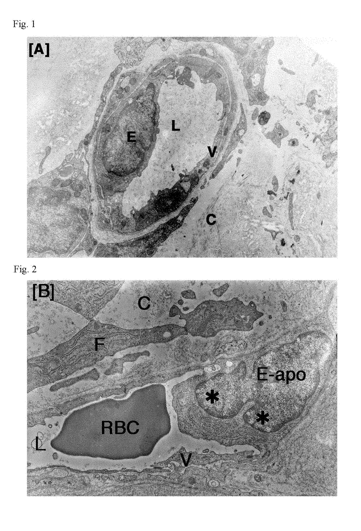 Antitumor agent