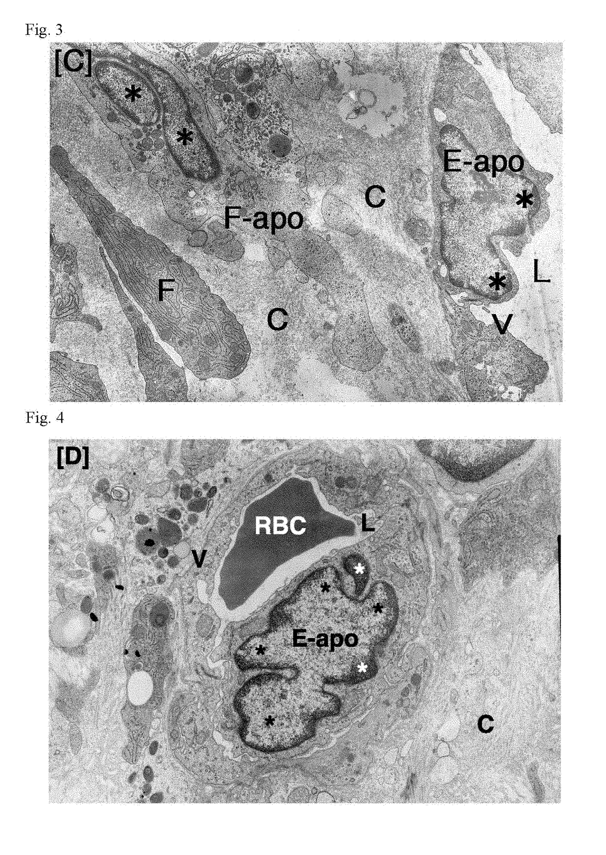 Antitumor agent