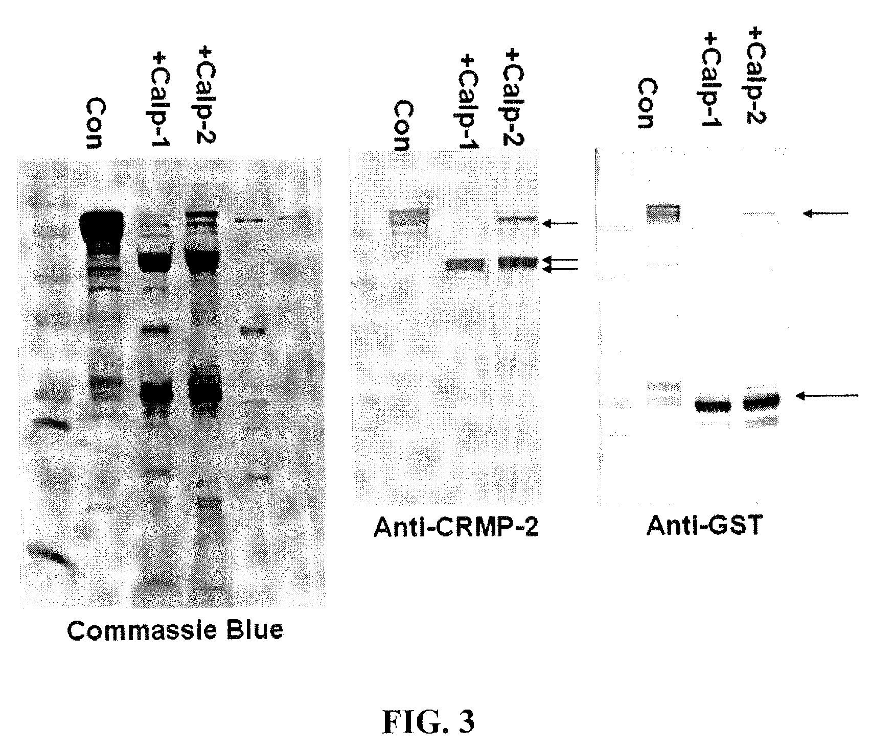 Synaptotagmin and Collapsin Response Mediator Protein as Biomarkers for Traumatic Brain Injury