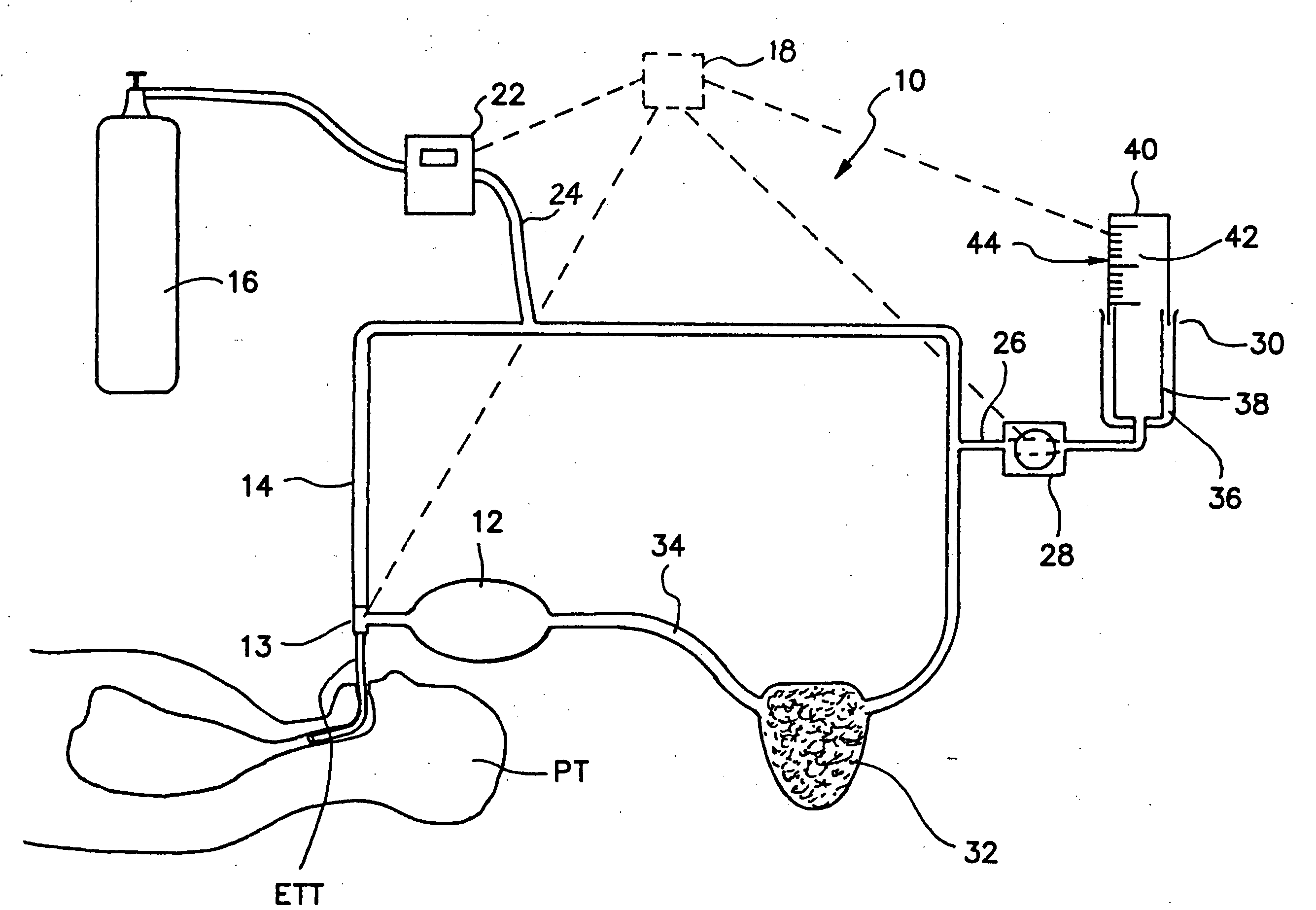 Stand-alone circle circuit with co2 absorption and sensitive spirometry for measurement of pulmonary uptake