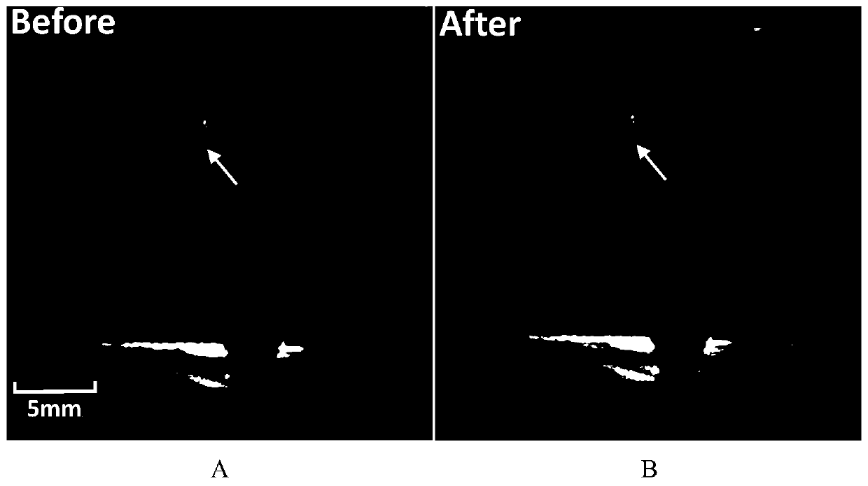 Single bioaerosol particle identification system based on laser capture and microwave radiation