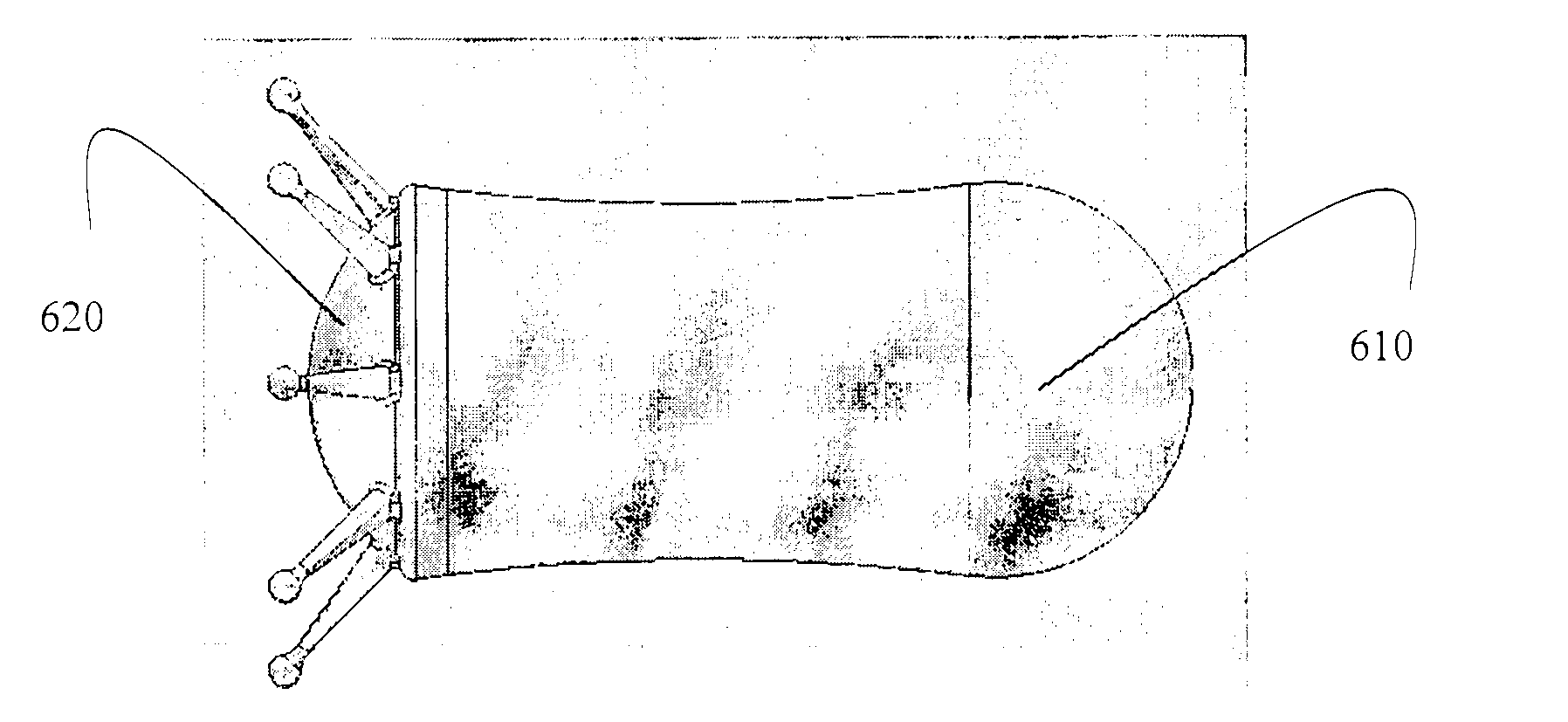 Medical device for treatment of urinary incontinence in females