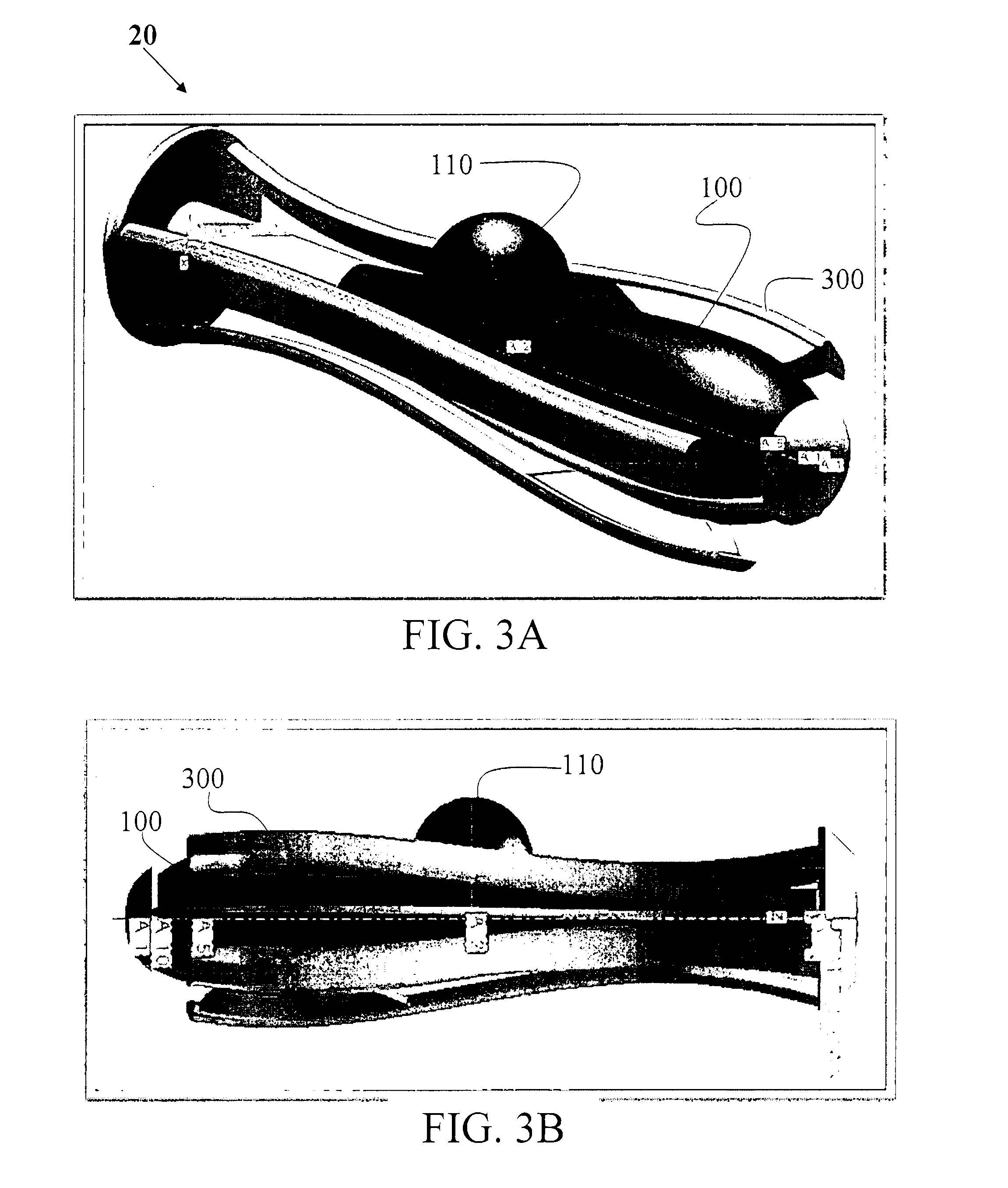 Medical device for treatment of urinary incontinence in females