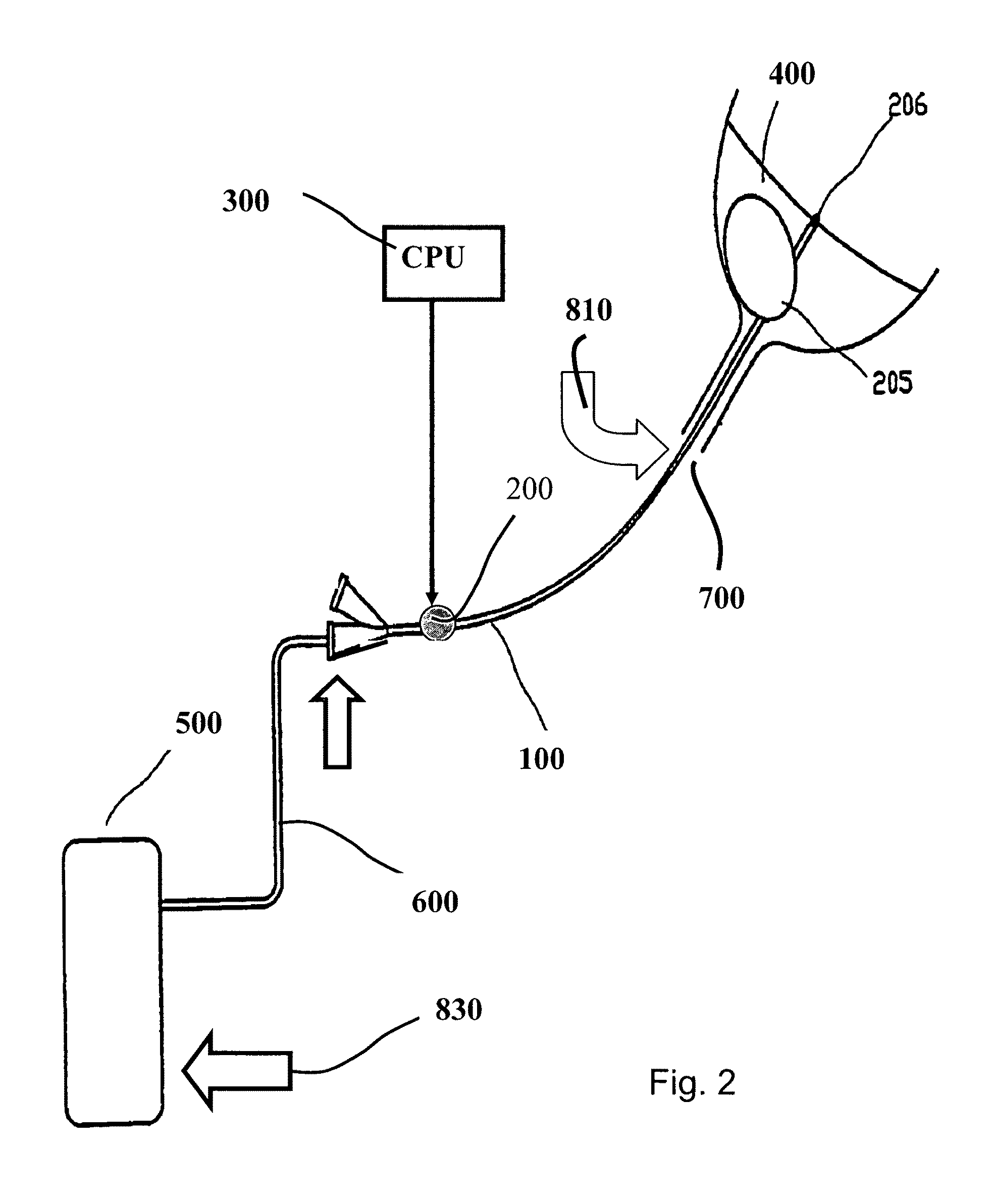 Acoustic add-on device for biofilm prevention in urinary catheter