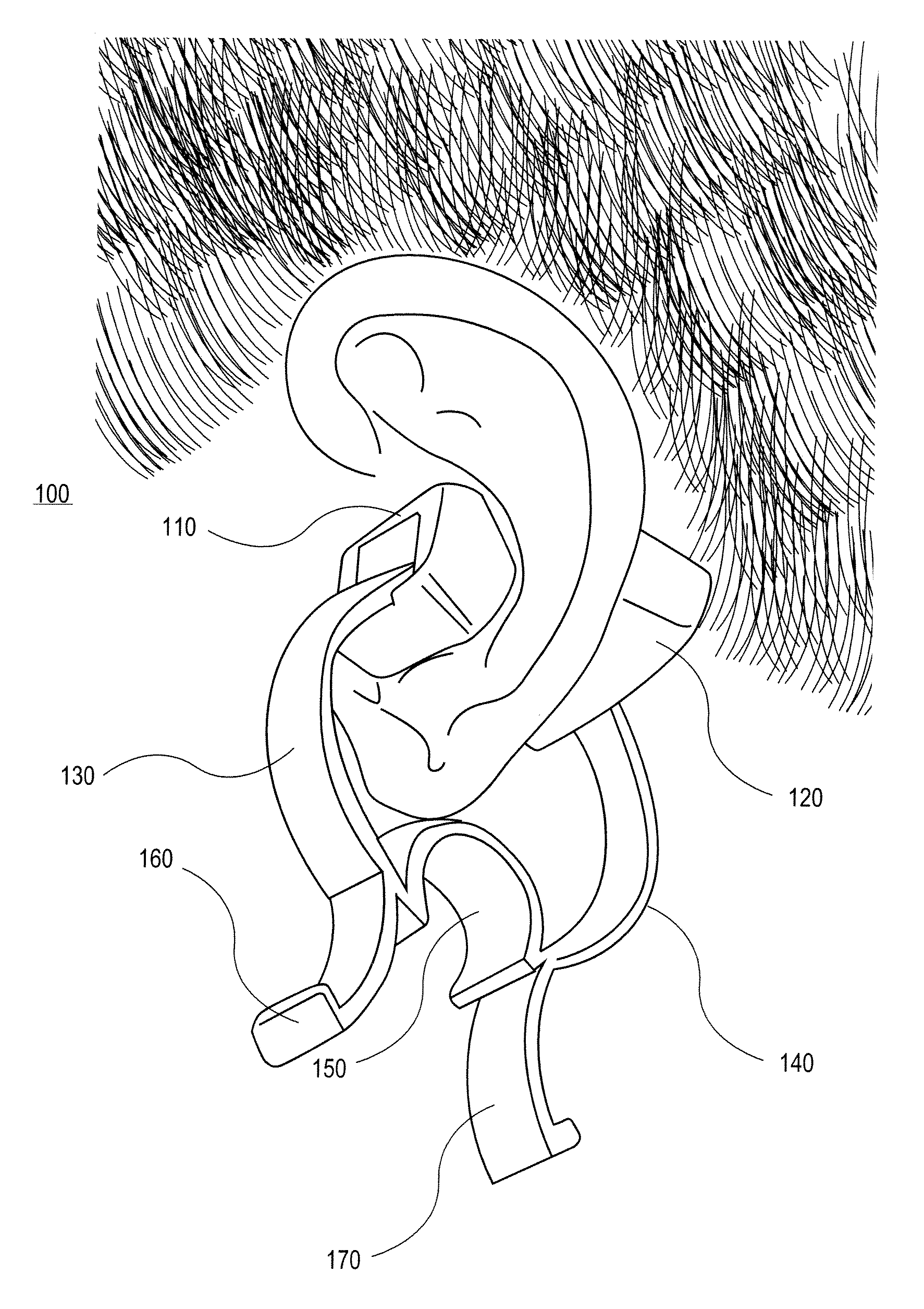 External ear-placed non-invasive physiological sensor