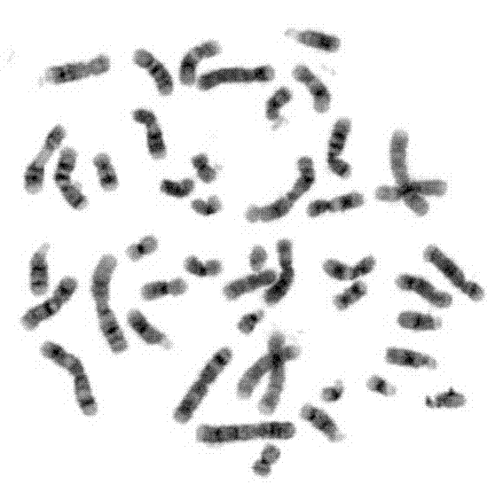 Marrow chromosome extraction kit