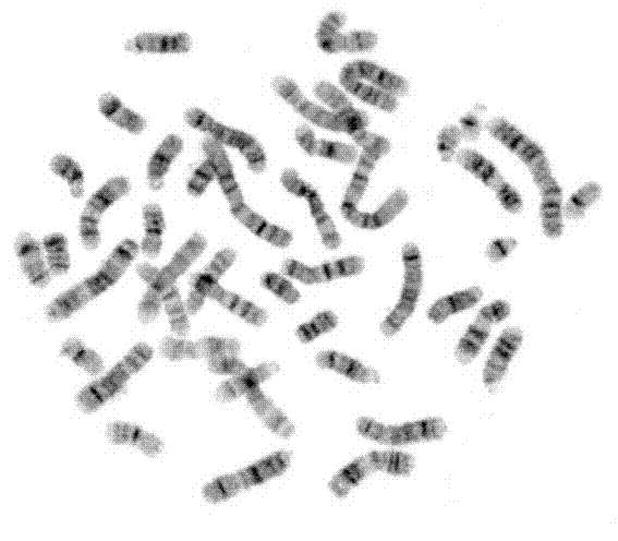 Marrow chromosome extraction kit