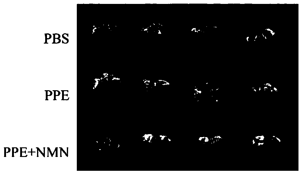 Use of beta-nicotinamide mononucleotide or precursor thereof in preparation of medicines or health products for treating or alleviating respiratory disorders or diseases