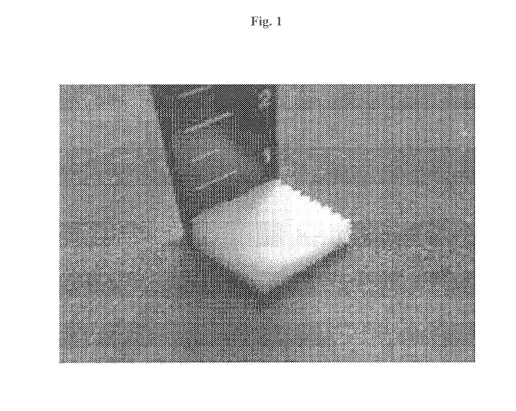 Complex support body for regenerating bone-cartilage, method for manufacturing thereof, and composition for treating bone and cartilage related diseases comprising same as active ingredient