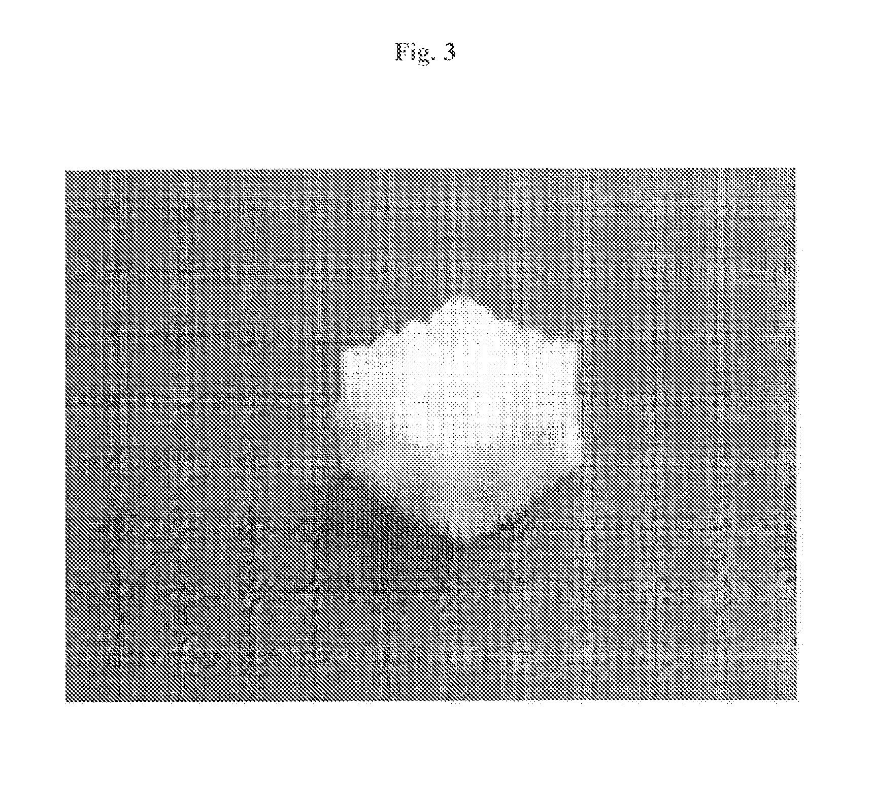 Complex support body for regenerating bone-cartilage, method for manufacturing thereof, and composition for treating bone and cartilage related diseases comprising same as active ingredient