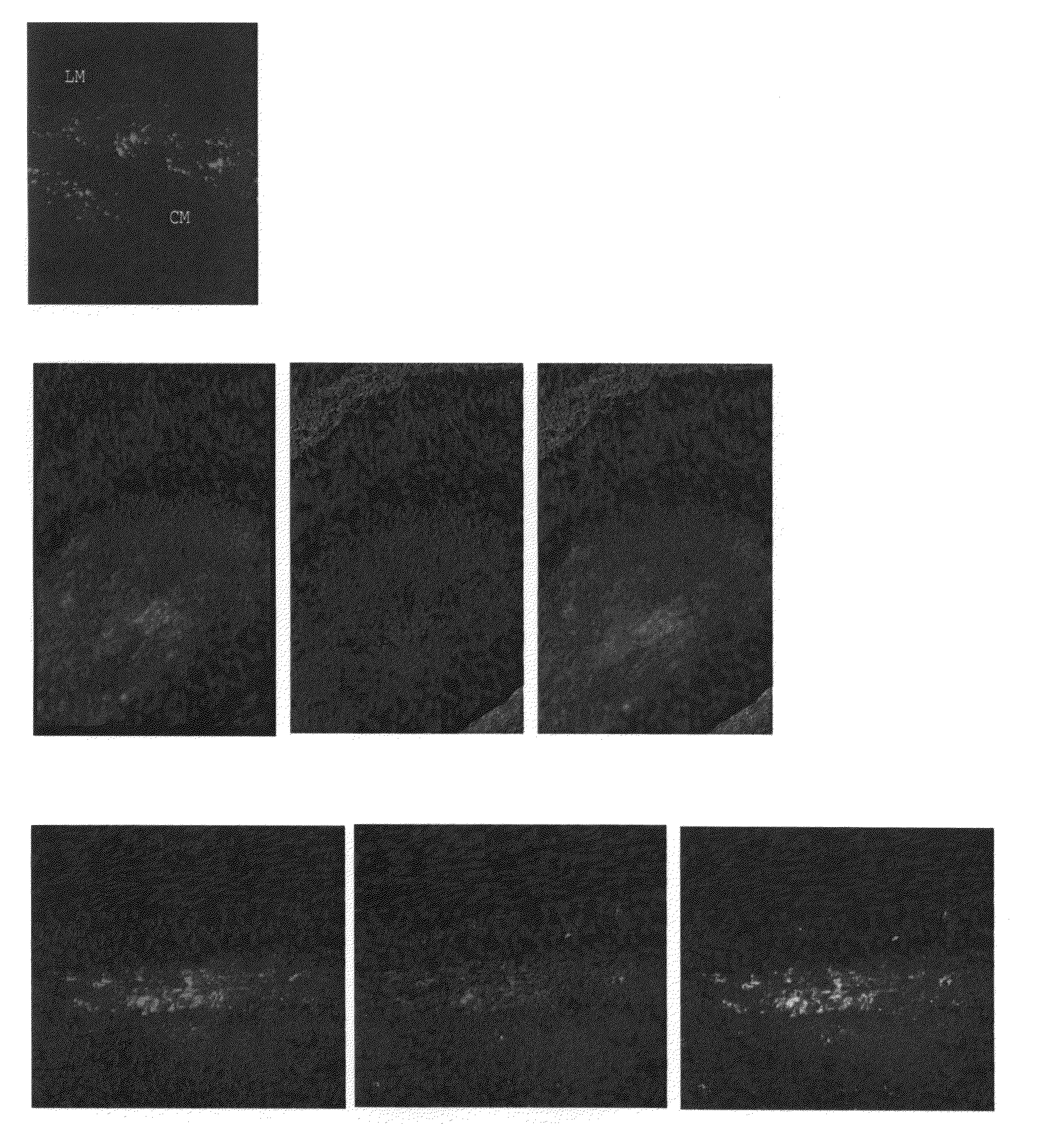 Muscle Derived Cells For The Treatment Of Gastro-Esophageal Pathologies And Methods Of Making And Using The Same