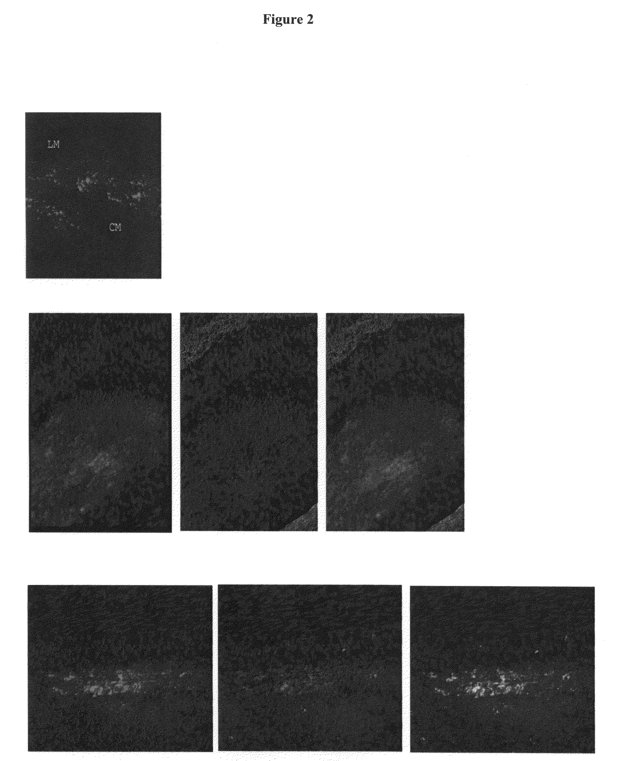 Muscle Derived Cells For The Treatment Of Gastro-Esophageal Pathologies And Methods Of Making And Using The Same