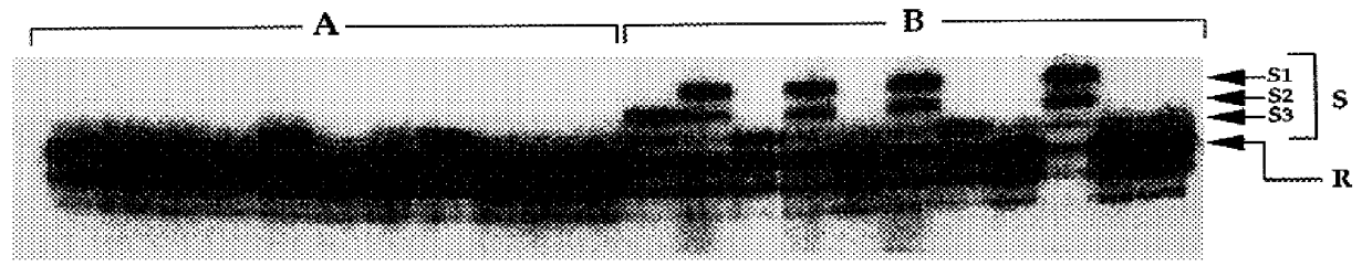 Method of identification of animals resistant or susceptible to disease such as ruminant brucellosis, tuberculosis, paratuberculosis and salmonellosis