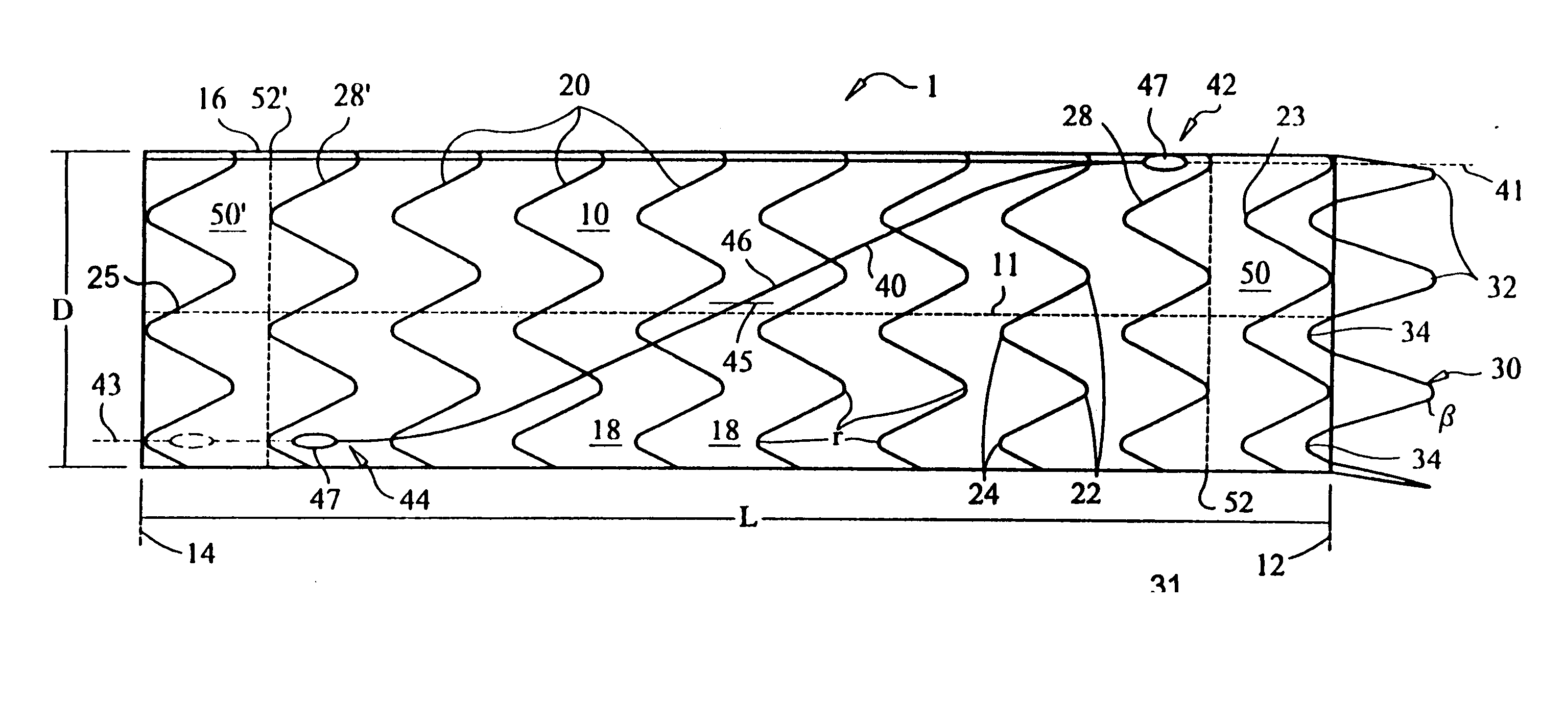 Stent graft