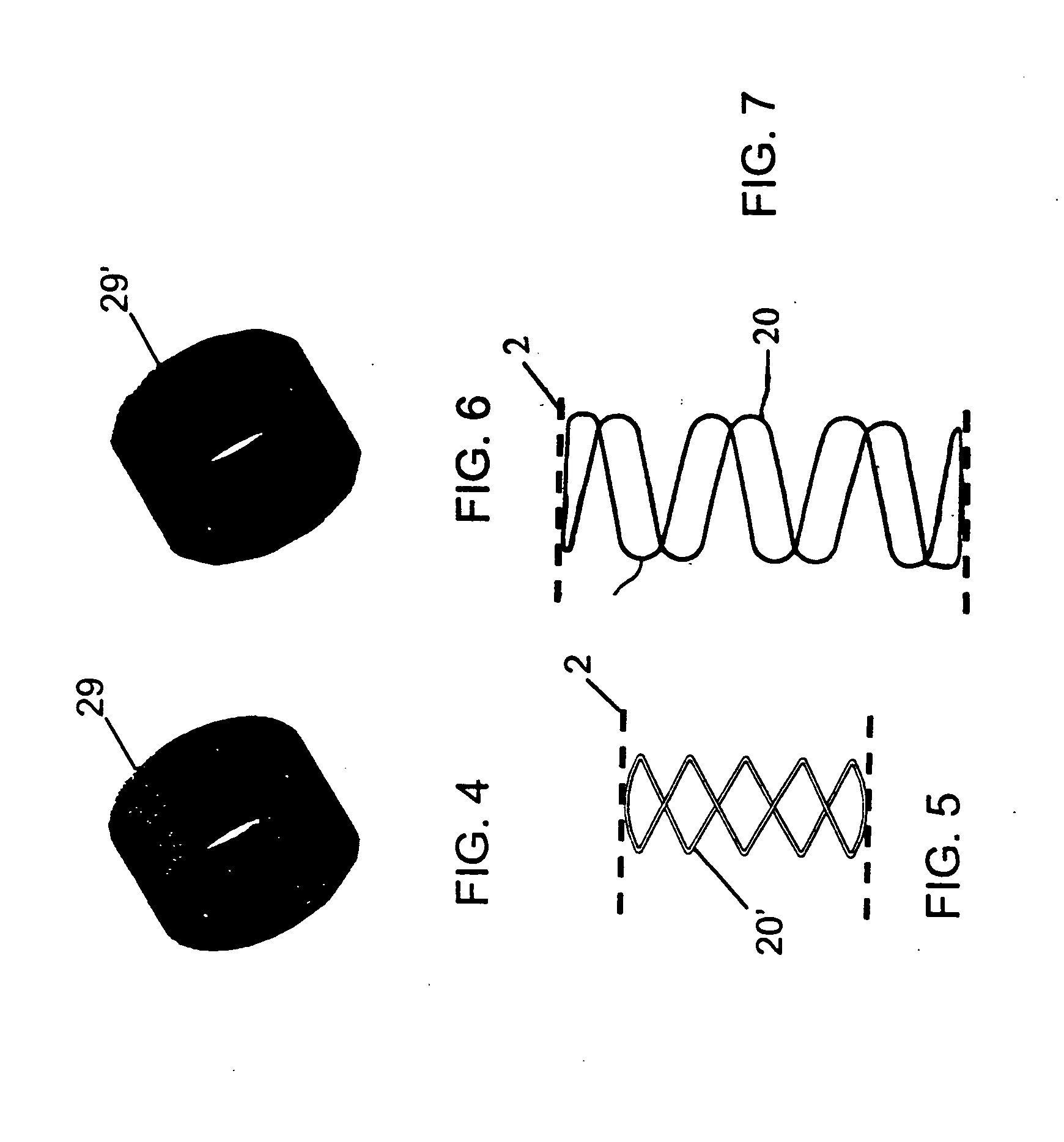 Stent graft